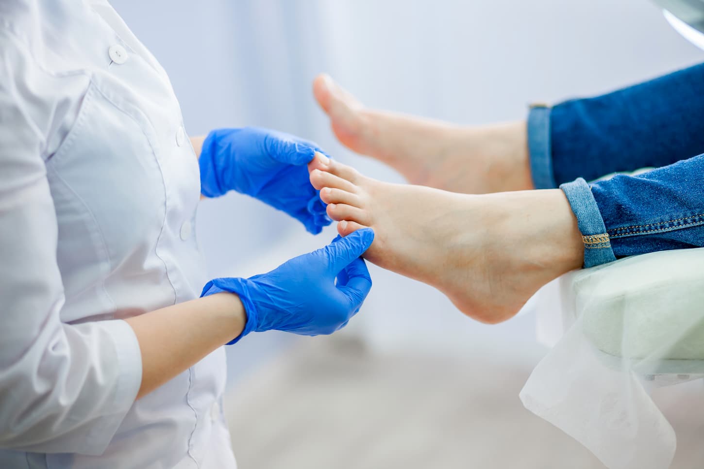 Comment soigner une mycose de l’ongle du pied ?